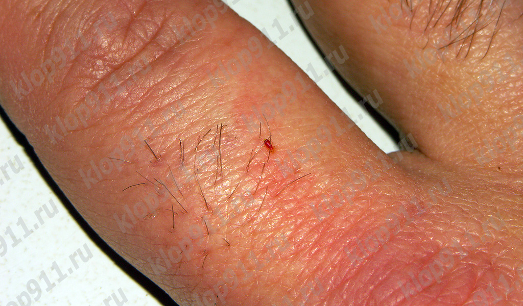 Larva bea sânge