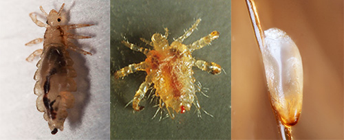 Nous nous familiarisons avec les caractéristiques de l'apparence et de la biologie de divers types de poux, voyons à quoi ils ressemblent et comment ils se reproduisent.