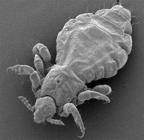 Pou de tête sous un microscope