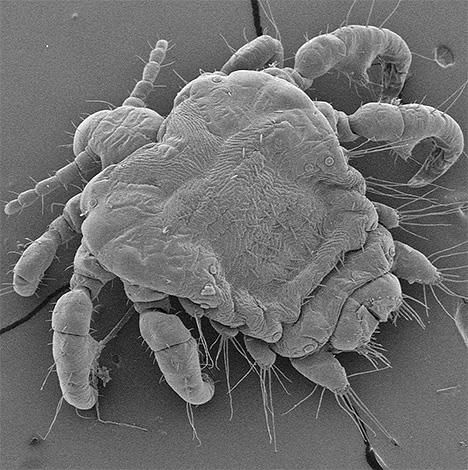 Pou du pubis au microscope