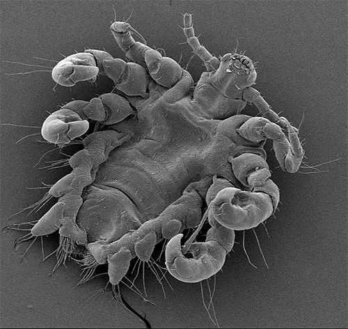 Une autre photo d'un pou du pubis au microscope électronique