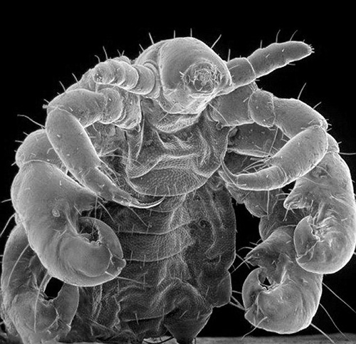 Voici à quoi ressemble un pou du pubis au microscope électronique