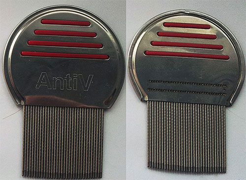 Ειδικές εγκοπές στα δόντια της χτένας AntiV παρέχουν αξιόπιστο χτένισμα όχι μόνο των ψειρών, αλλά και των κόνιδων.