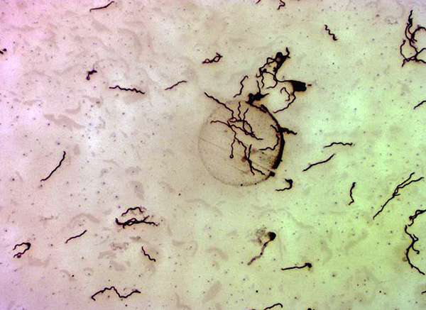 Borrelia burgdorferi κάτω από μικροσκόπιο (σε μεγέθυνση 400x).