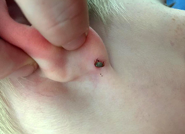 Un posto preferito per le punture di zecca è dietro le orecchie e tra i capelli sulla testa.