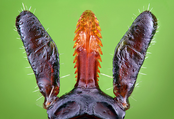 Ecco come appare l'ipostoma di una zecca al microscopio.