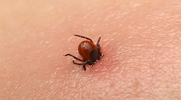 Durante un morso, la zecca è in grado di affondare abbastanza profondamente nella pelle: la testa del parassita è spesso completamente nella ferita.
