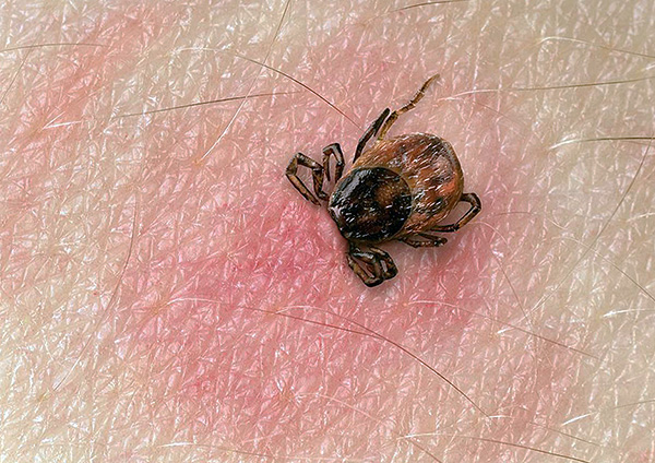 Spesso le persone notano un segno di spunta solo quando il parassita è già riuscito ad attaccarsi e iniziare il processo di saturazione con il sangue.