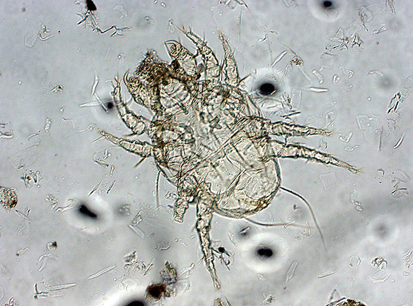 Κνησμός ψώρας (Sarcoptes scabiei) 