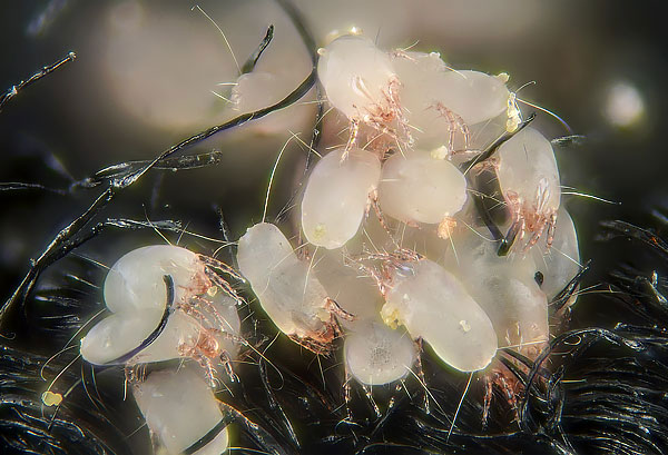 Τα ακάρεα σκόνης Dermatophagoides pteronyssinus είναι σχεδόν αδύνατο να εντοπιστούν με γυμνό μάτι σε ένα χαλί, γι' αυτό οι περισσότεροι άνθρωποι υποθέτουν ότι δεν βρίσκονται στο σπίτι.