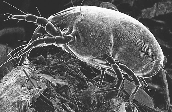 Dermatophagoides pteronyssinus (φωτογραφία που λήφθηκε με ηλεκτρονικό μικροσκόπιο σάρωσης).