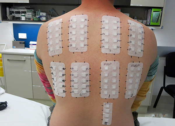 Ένα παράδειγμα χρήσης ενός patch test
