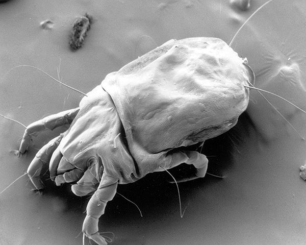 Dermatophagoides pteronyssinus κάτω από ηλεκτρονικό μικροσκόπιο