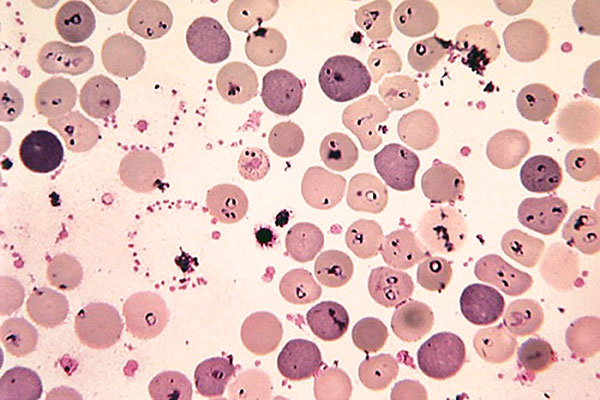 Piroplasmosi nel sangue